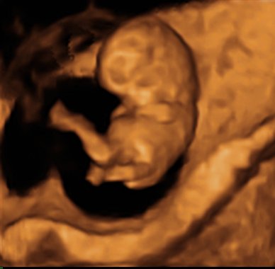 4d ultrasound video at 10 weeks