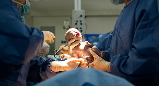 Cesarean Section and Delivery